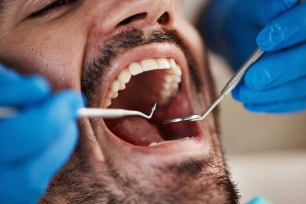 Best Urgent Tooth Repair  in La Honda, CA